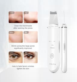 image-Ultrasonic Skin Scrubber Deep Face Cleaning Machine Peeling Shovel Facial Pore Cleaner Face Skin Scrubber Lift Machine