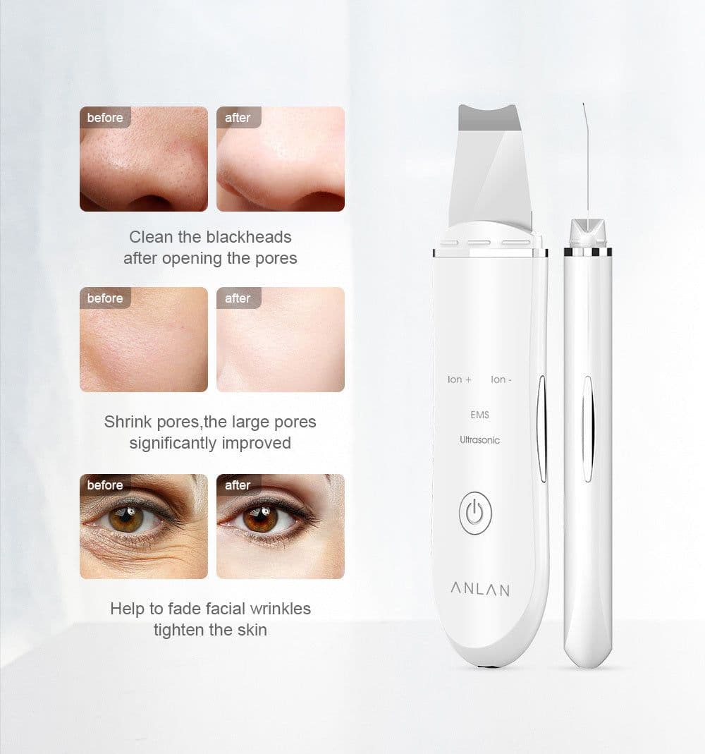 image-Ultrasonic Skin Scrubber Deep Face Cleaning Machine Peeling Shovel Facial Pore Cleaner Face Skin Scrubber Lift Machine