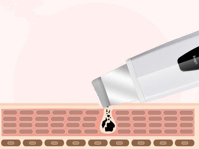 image-Ultrasonic ion skin cleanser