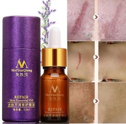 image-Scar Skin Repair Essential Oil Lavender Care Natural Skin Pure Remove Ance Burn Strentch Marks Removal Scar 10 ML