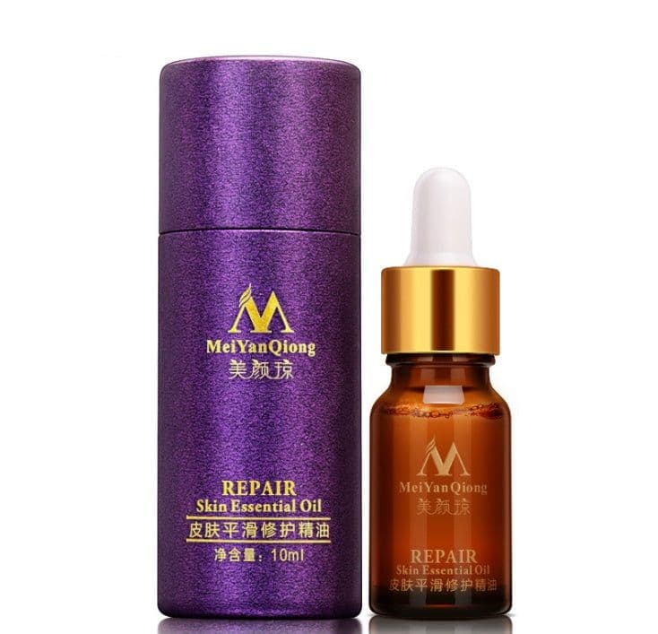 image-Scar Skin Repair Essential Oil Lavender Care Natural Skin Pure Remove Ance Burn Strentch Marks Removal Scar 10 ML