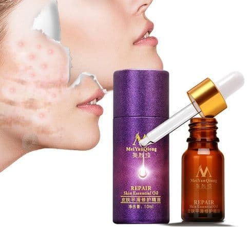 image-Scar Skin Repair Essential Oil Lavender Care Natural Skin Pure Remove Ance Burn Strentch Marks Removal Scar 10 ML