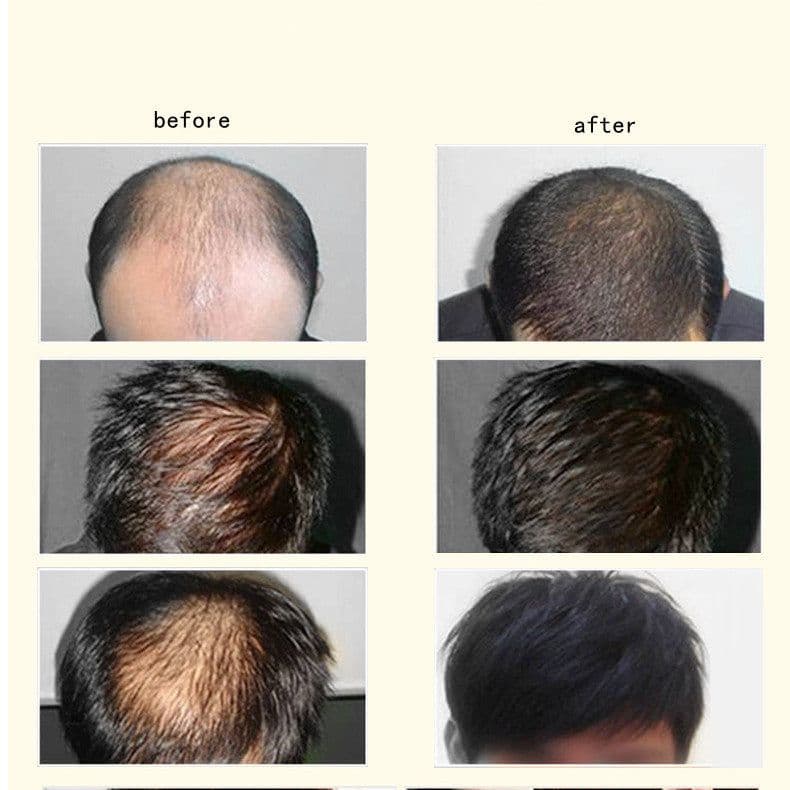 image-Ginger Anti-hair Loss Hair Maintenance 30ml
