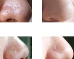 image-Bamboo charcoal blackhead nasal mask cream shrink pores to black set suit black thorn cream