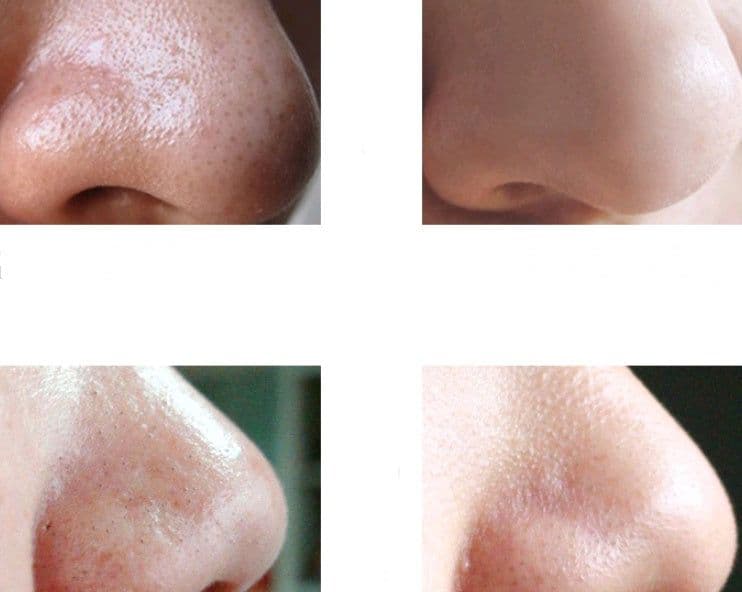 image-Bamboo charcoal blackhead nasal mask cream shrink pores to black set suit black thorn cream
