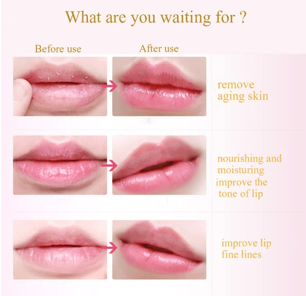 image-10pcs Golden Lip Masks