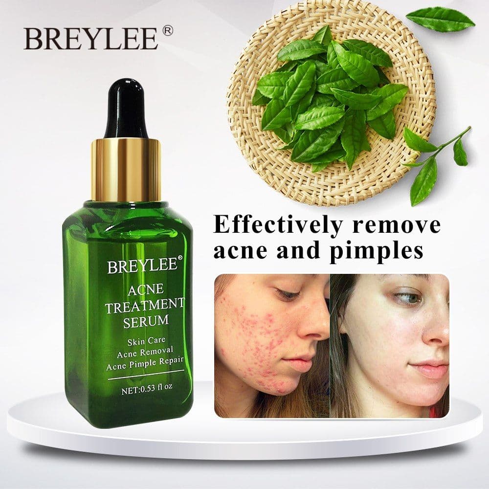 image-BREYLEE Acne Treatment Serum Face Facial Anti Acne Scar Removal Cream Skin Care Whitening Repair Pimple Remover For Acne