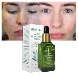 image-BREYLEE Acne Treatment Serum Face Facial Anti Acne Scar Removal Cream Skin Care Whitening Repair Pimple Remover For Acne