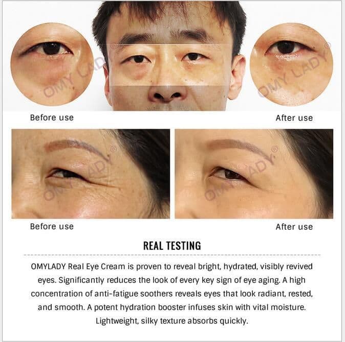 image-Eye cream, eye wrinkle cream