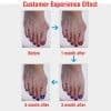 image-1 Pair Silicone Foot Care Hallux Valgus Corrector