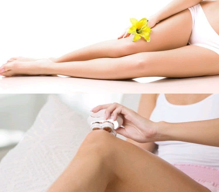 image-Hair Removal Device
