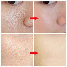 image-Pore Refining Serum