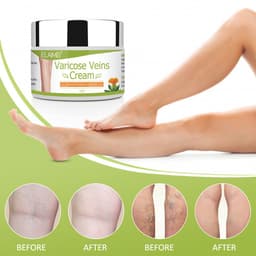 image-Vein red blood streak repair cream