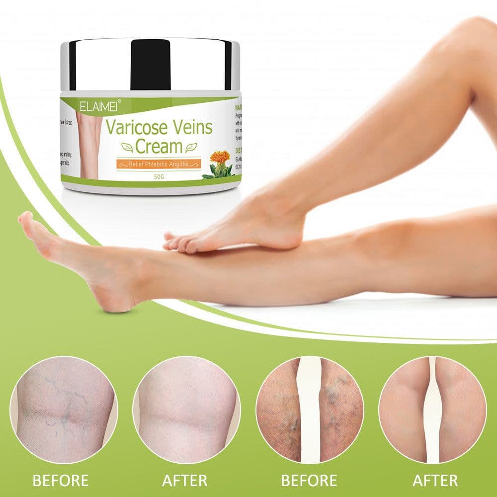 image-Vein red blood streak repair cream