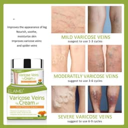 image-Vein red blood streak repair cream
