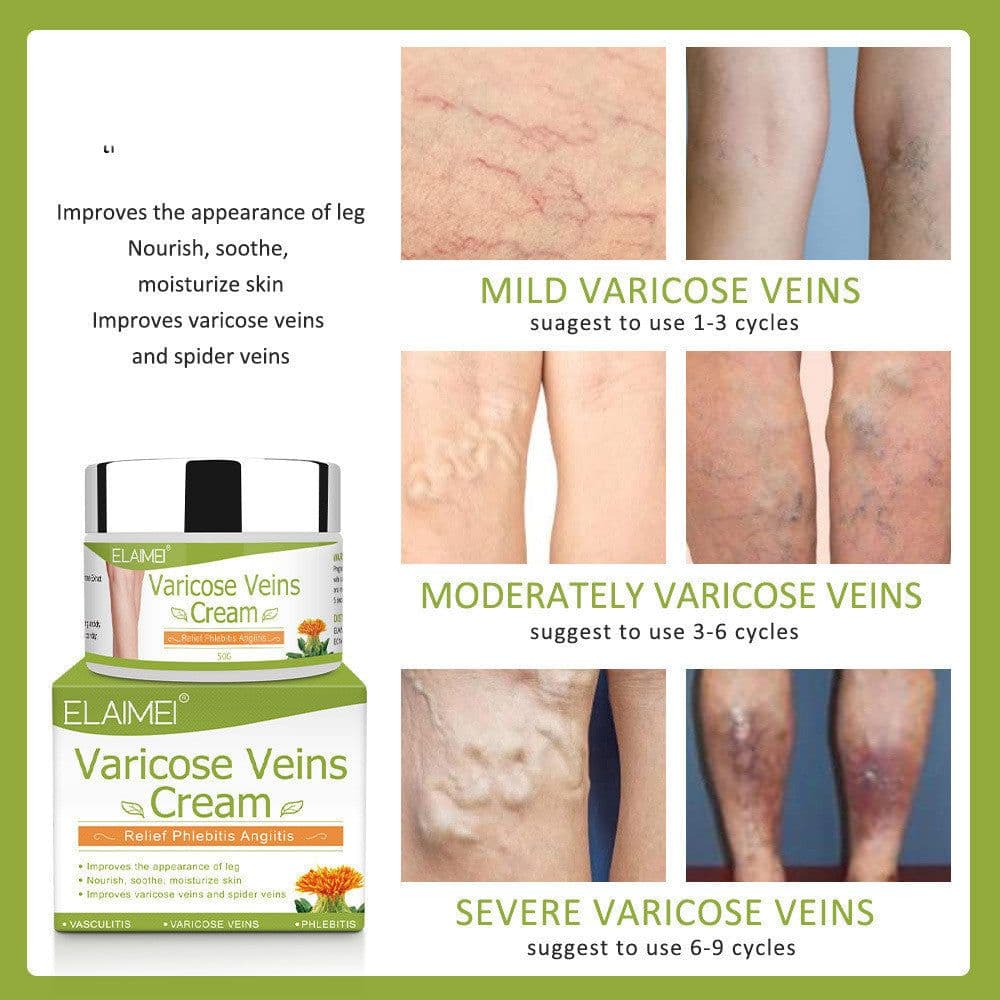 image-Vein red blood streak repair cream