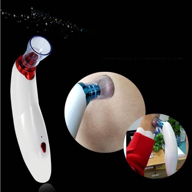 image-Electric Blackhead Suction Device To Remove Acne, Horny Pores And Cleansing Multifunctional Cupping Cleaner