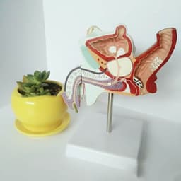 image-Anatomical Urinary System Model Of Male Internal Reproductive Disease