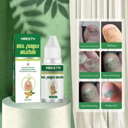 image-Nail Fungal Treatment Feet Care Nail Foot Toe Nail Fungus Removal Gel Anti Infection Paronychia Onychomycosis