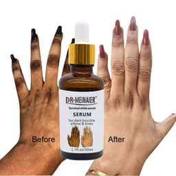image-Hand Brightening Moisturizing Lotion South Africa India