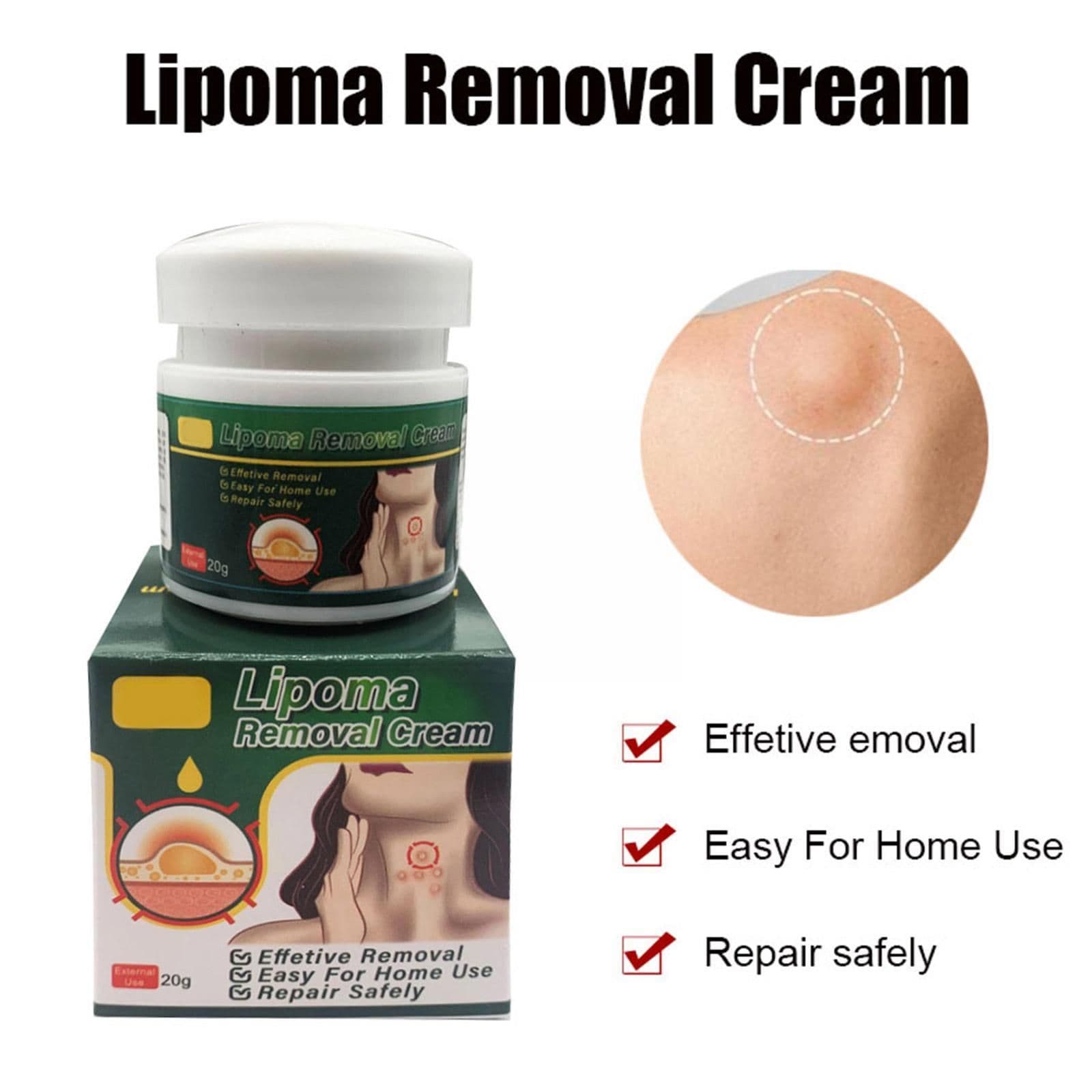 image-Chinese Medicine Multiple Anti-tumor Lipoma Pain Cream