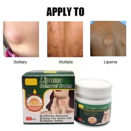 image-Chinese Medicine Multiple Anti-tumor Lipoma Pain Cream