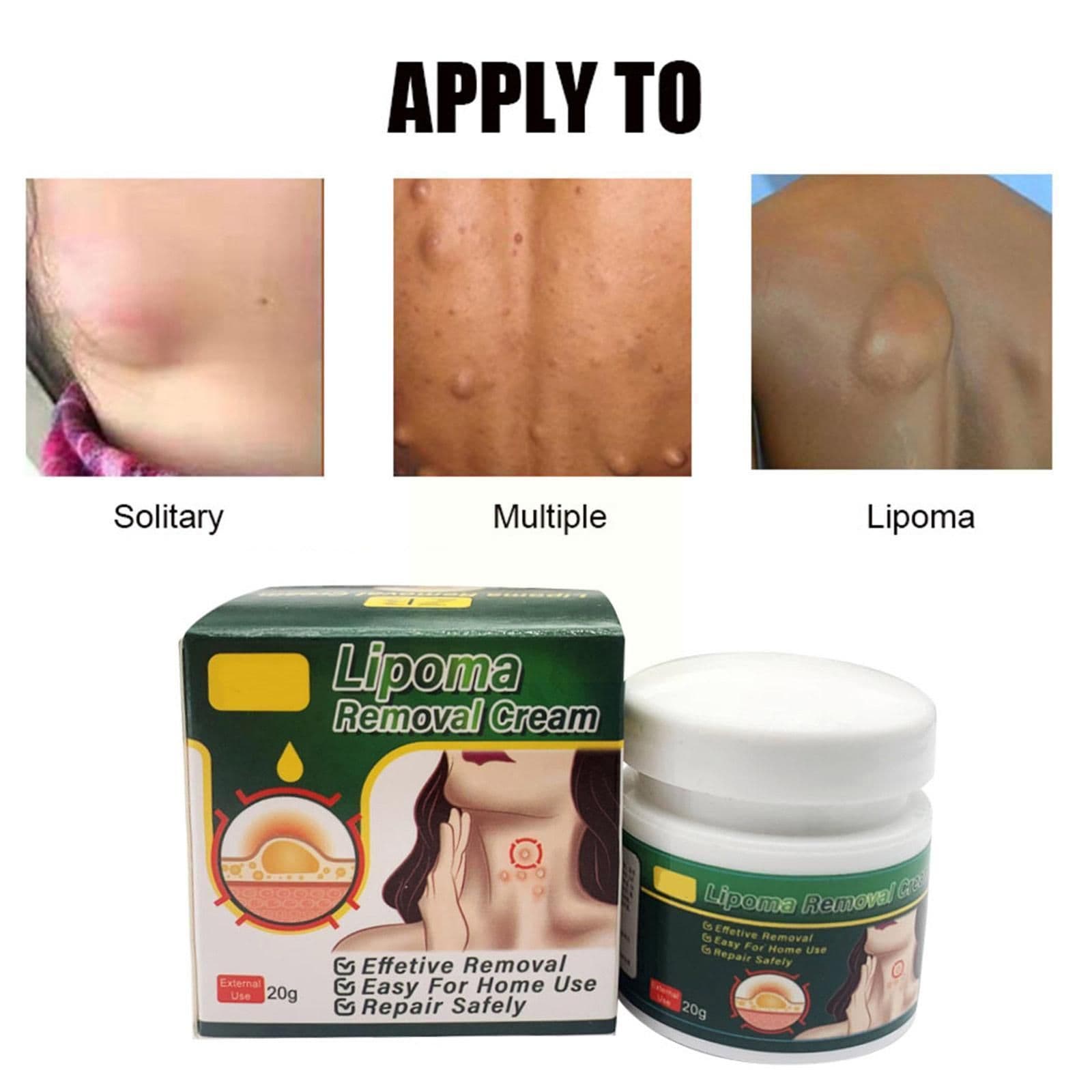 image-Chinese Medicine Multiple Anti-tumor Lipoma Pain Cream