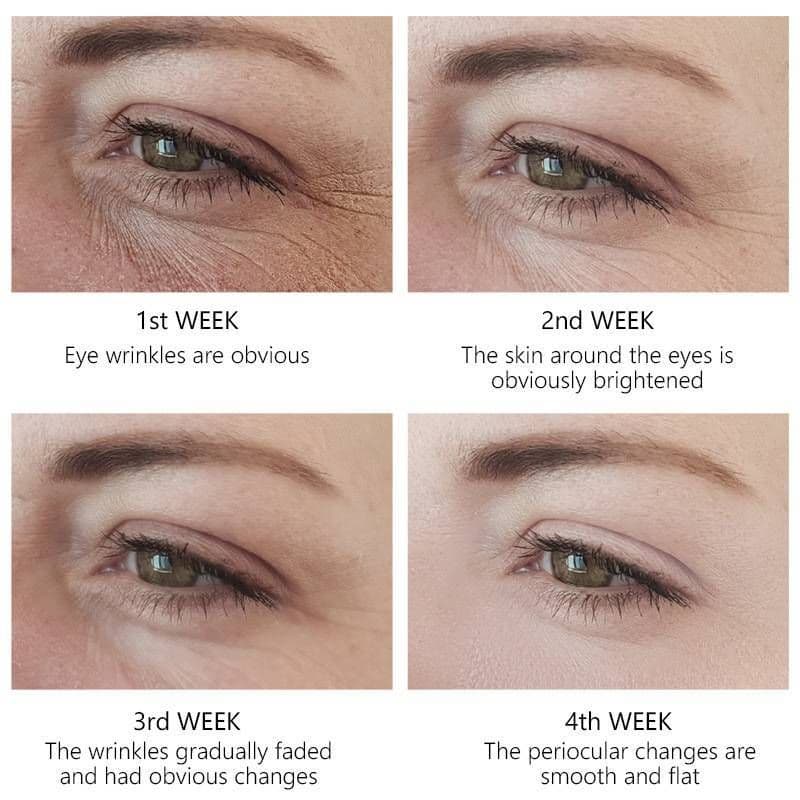 image-Eye Serum Repairs And Tightens Fine Lines Around Eyes