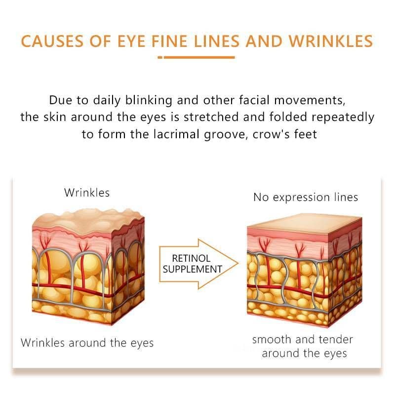 image-Eye Serum Repairs And Tightens Fine Lines Around Eyes