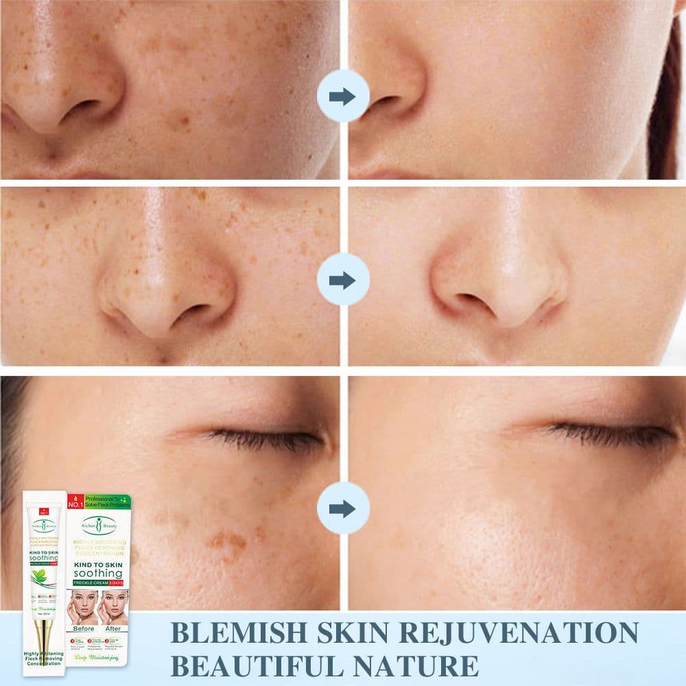 image-Men And Women Skin Lifting Cosmetics Anti-Spot Cream
