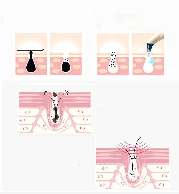 image-Electric Blackheads Remover Blackheads Artifact Household Pore Cleaner Microcrystalline Beauty Apparatus