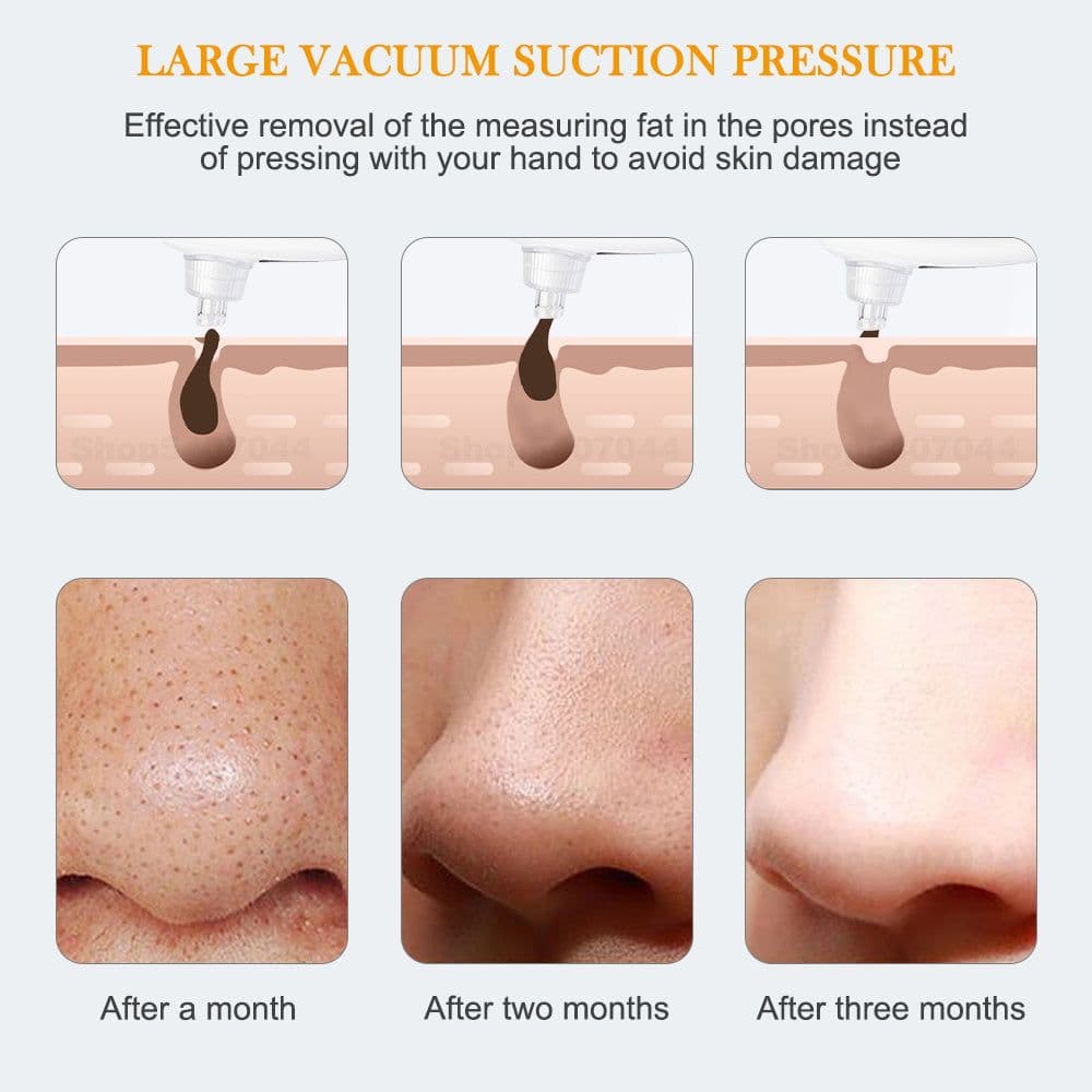 image-Pore And Acne Removal Cleansing Beauty Spatula Small Face Wash