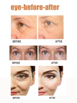 image-Eye Cream To Remove Eye Bags, Eye Cream , Eye Bag Care, Eye Care
