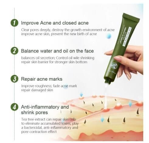 image-Tea Tree Acne Acne Gel 25G Acne Balancing Water And Oil To Fade Scars And Spots