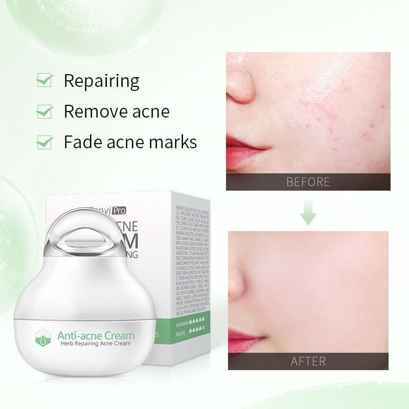 image-Herbal Ointment Moisturizing Facial Cream Skin Care Products