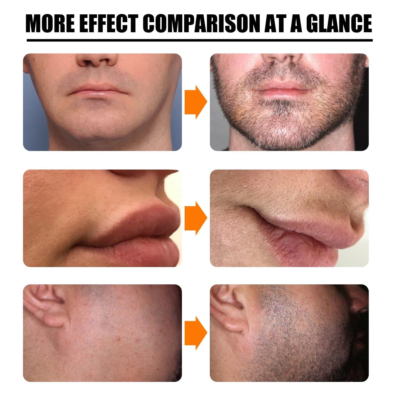 image-Beard Growth Spray Set Nourishing Moisturizing