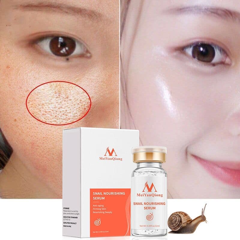 image-High Quality Snail Hyaluronic Acid Liquid Whitening Spot Serum
