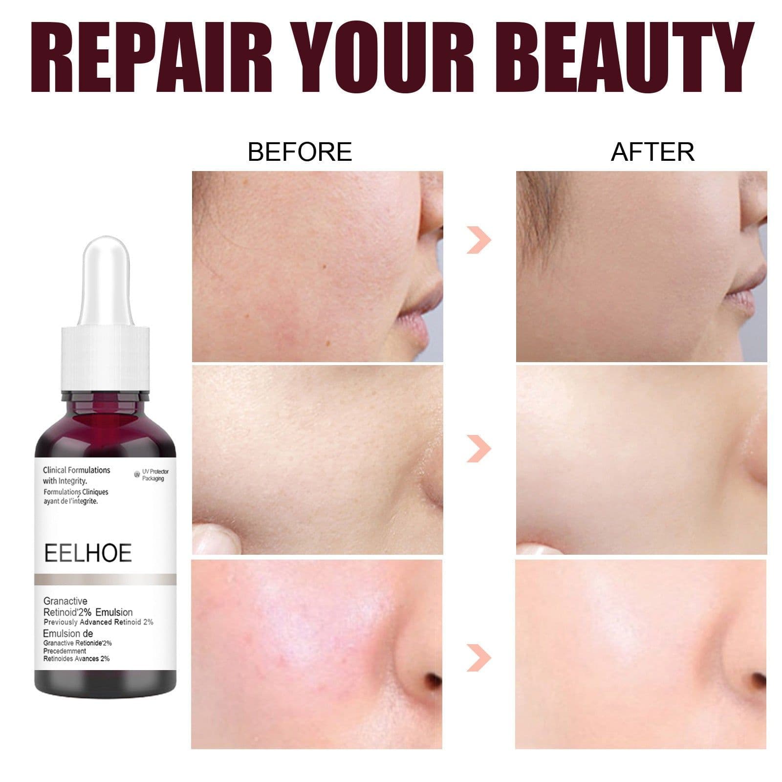 image-Salicylic Acid Moisturizing Moisturizing Gentle Care Smoothing Pore Refining Serum