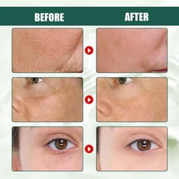 image-Intensive Anti-wrinkle Fade Fine Lines And Dark Circles Adjust Skin Tone Tighten And Moisturize Skin Care