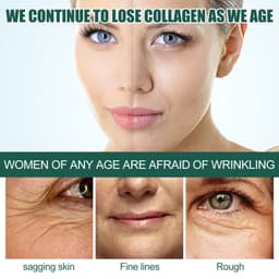 image-Intensive Anti-wrinkle Fade Fine Lines And Dark Circles Adjust Skin Tone Tighten And Moisturize Skin Care