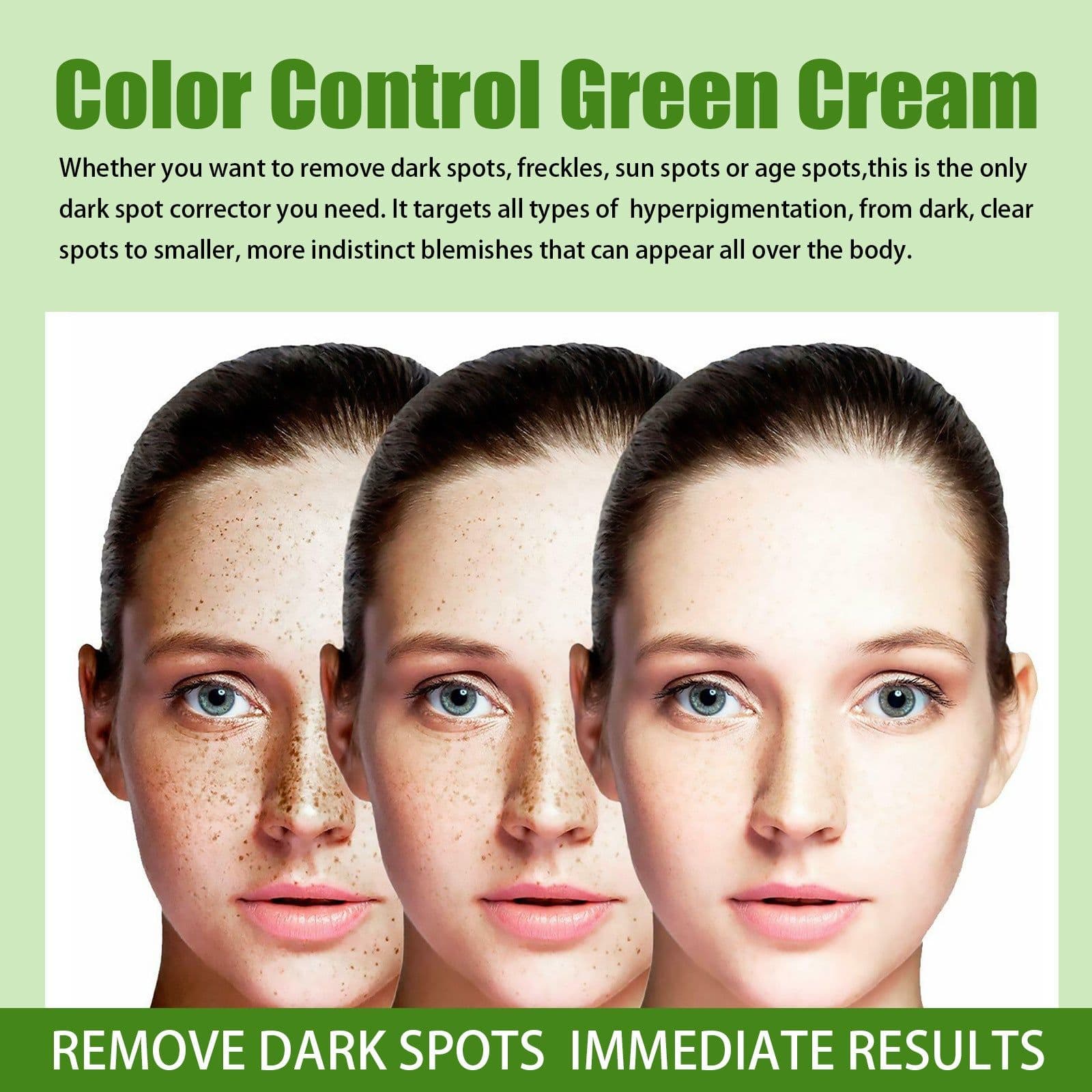 image-Lighten Spots Green Cream Freckles Decompose Pigments