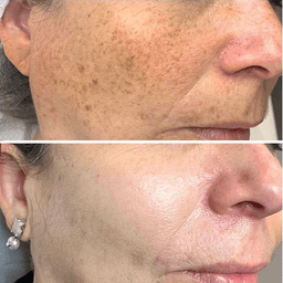 image-Facial Skin Fade Spots Anti-wrinkle Lifting Tightening Moisturizing Oil