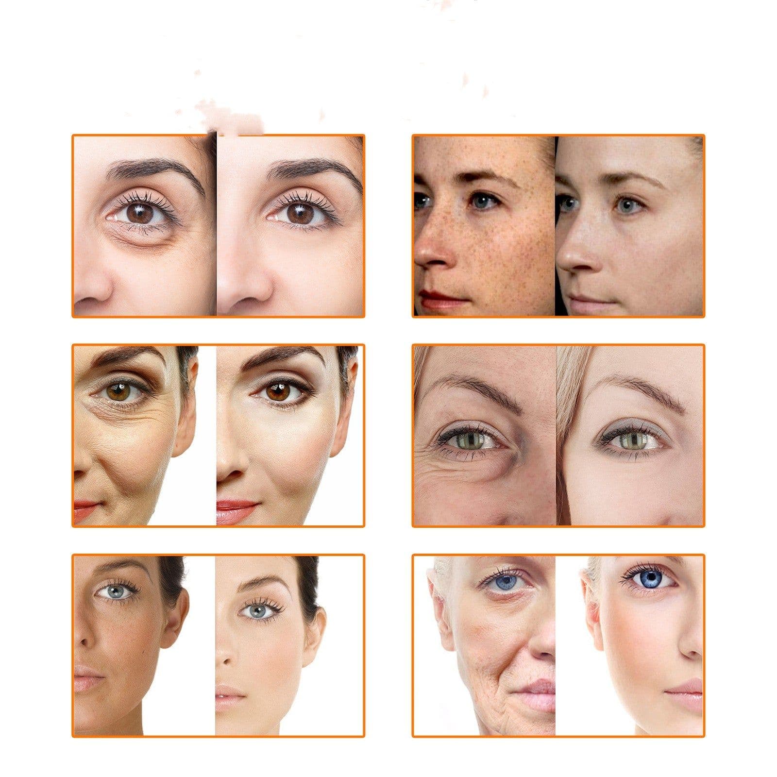 image-Facial Skin Fade Spots Anti-wrinkle Lifting Tightening Moisturizing Oil