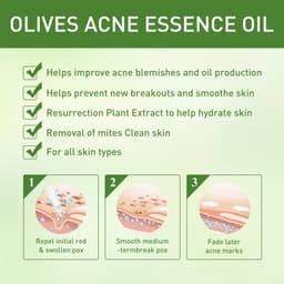 image-Remove Face Oil Acne Gentle Moisturizing Acne Pit Repair Liquid Fade Face Acne Marks Essential Oil