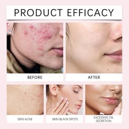 image-Kojic Acid Turmeric Cleansing Pads Beauty Hot-sale