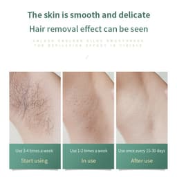 image-Women Painless Laser Epilator Permanent Hair Removal Device