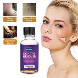 image-Foreign Trade Cross-Border Eelhoe Skin Verrucous Remover To Solve Skin Verrucous