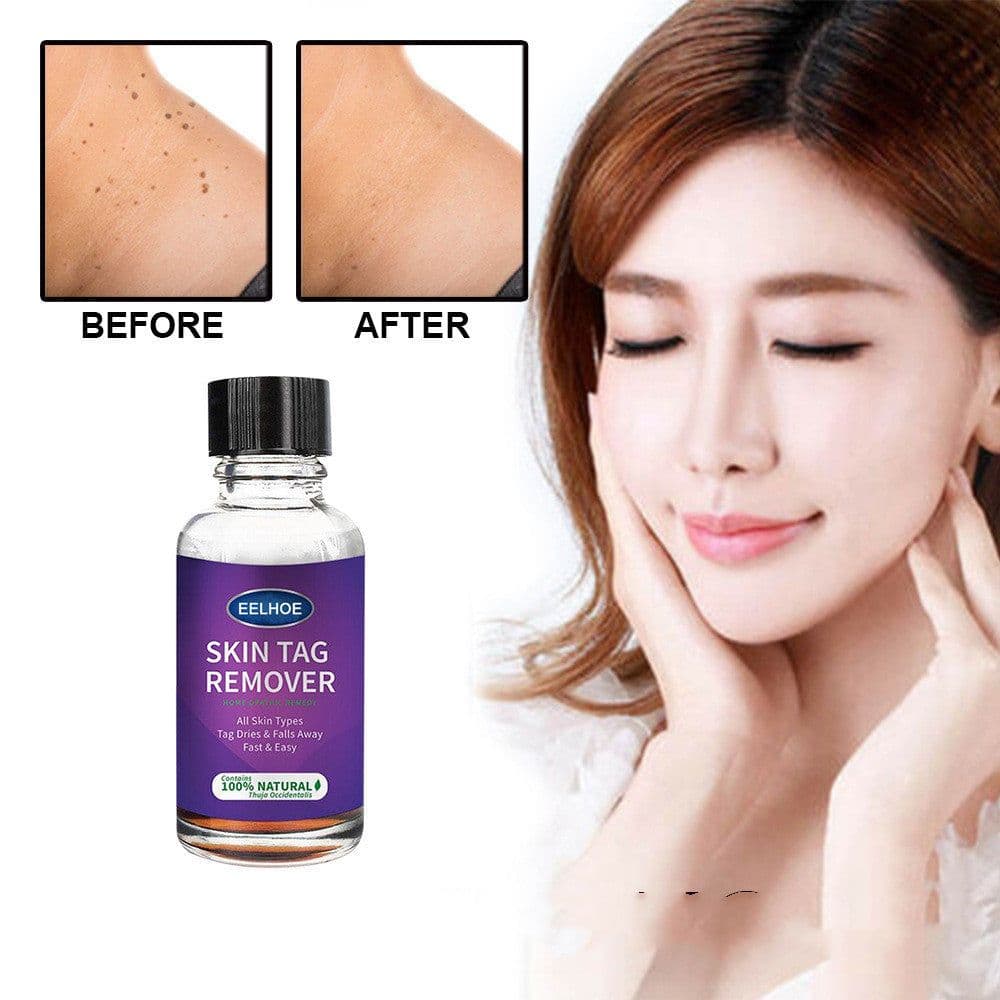 image-Foreign Trade Cross-Border Eelhoe Skin Verrucous Remover To Solve Skin Verrucous
