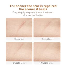 image-Traditional Chinese Medicine Scar Removal Cream Care Cream Skin Care Products