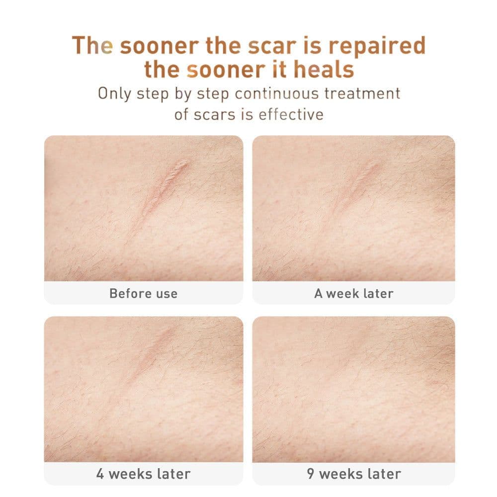 image-Traditional Chinese Medicine Scar Removal Cream Care Cream Skin Care Products